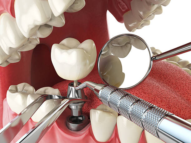 Best Weekend Emergency Dentist in Lake Placid, NY